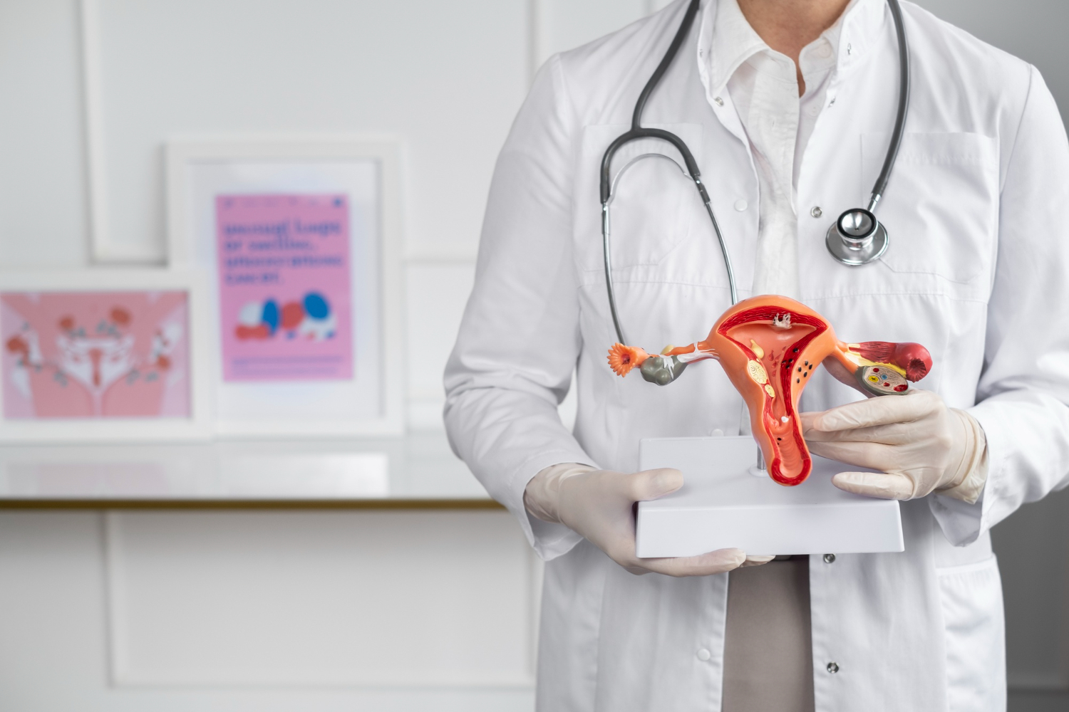 What Are Uterine Fibroids?